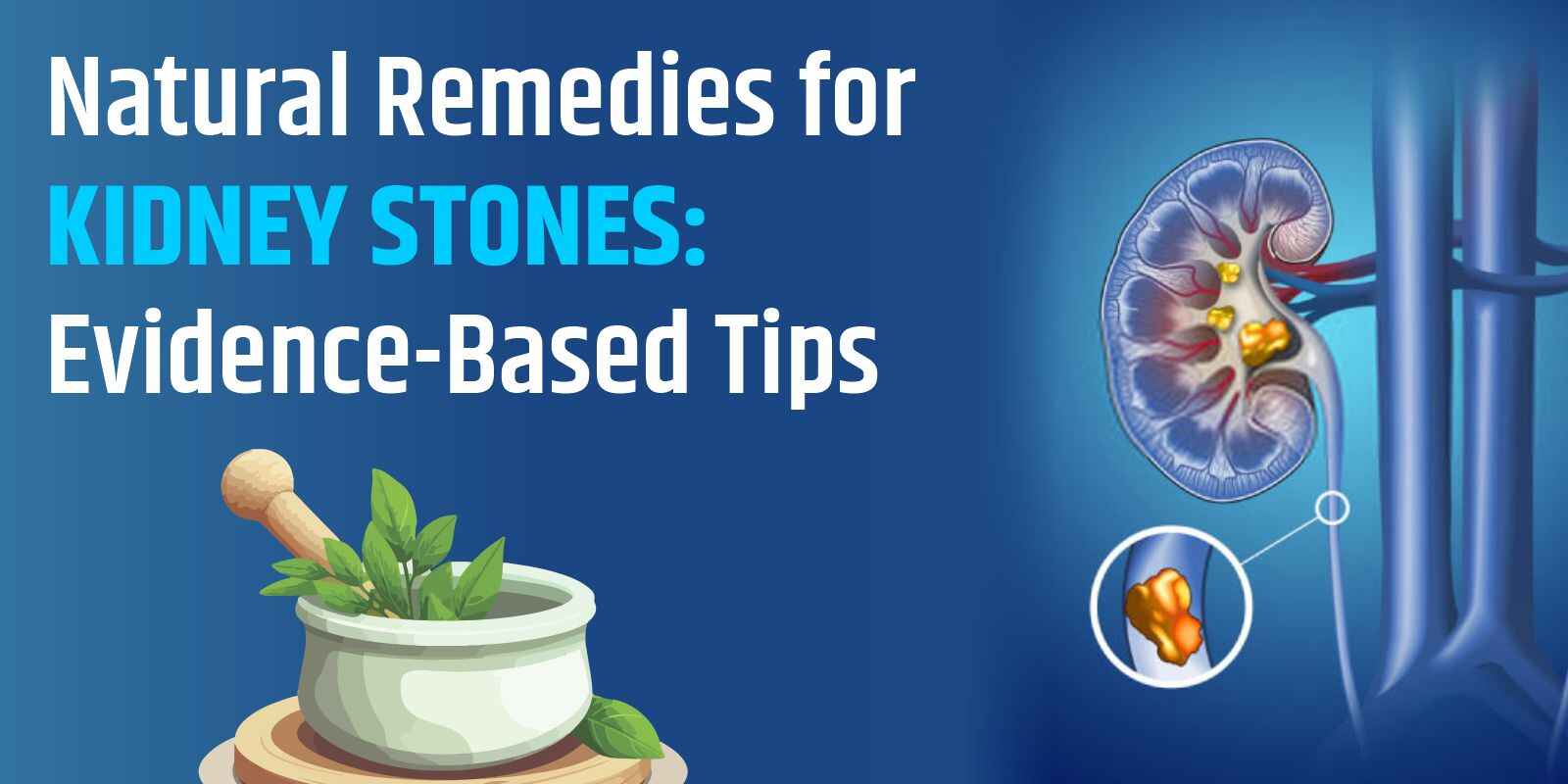 Natural Remedies for Kidney Stones: Evidence-Based Tips